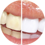 Rehabilitación y estética dental