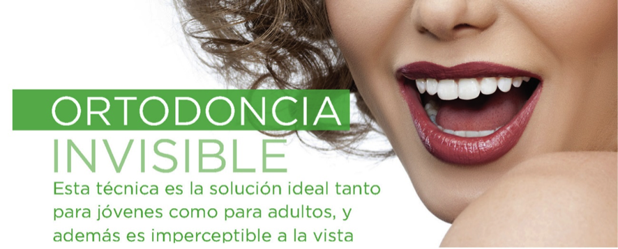 https://odontologiacastano.com/wp-content/uploads/2017/04/ortodoncia-invisible.png
